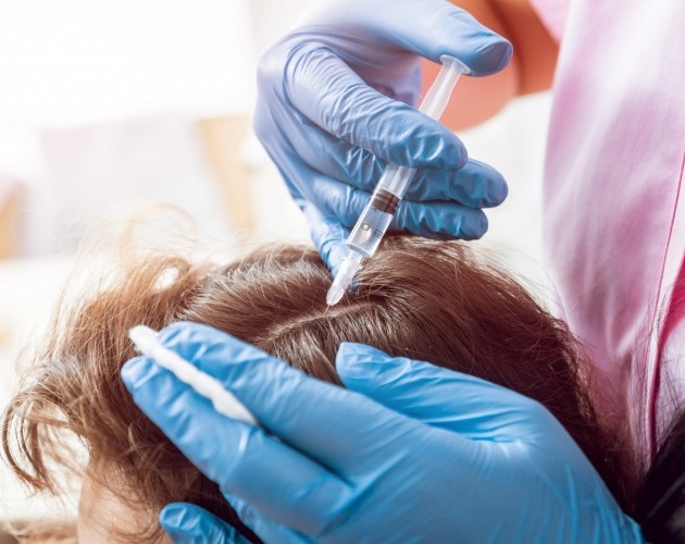 Microinyecciones de dutasterida